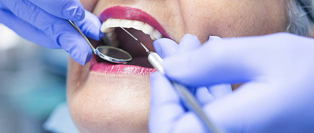 Best Emergency Treatment for Oral Infections in Gluckstadt, MS